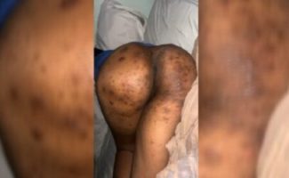 Hannah Yansh Leak Video with craw craw